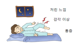 당뇨병 말초신경병증 예