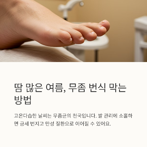 땀 많고 습한 여름, 무좀 번식 막는 실전 방어법