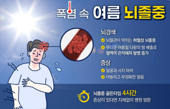 폭염과 뇌졸중 위험 증가 경고 관련 이미지