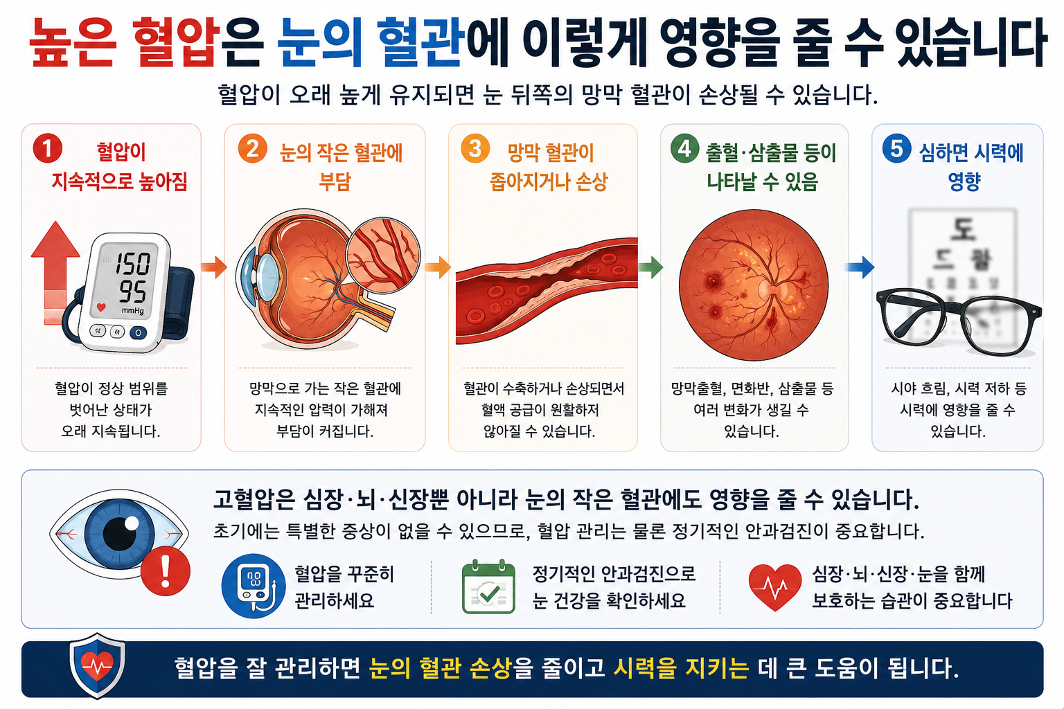 높은 혈압이 망막의 작은 혈관에 미치는 영향을 설명한 그림