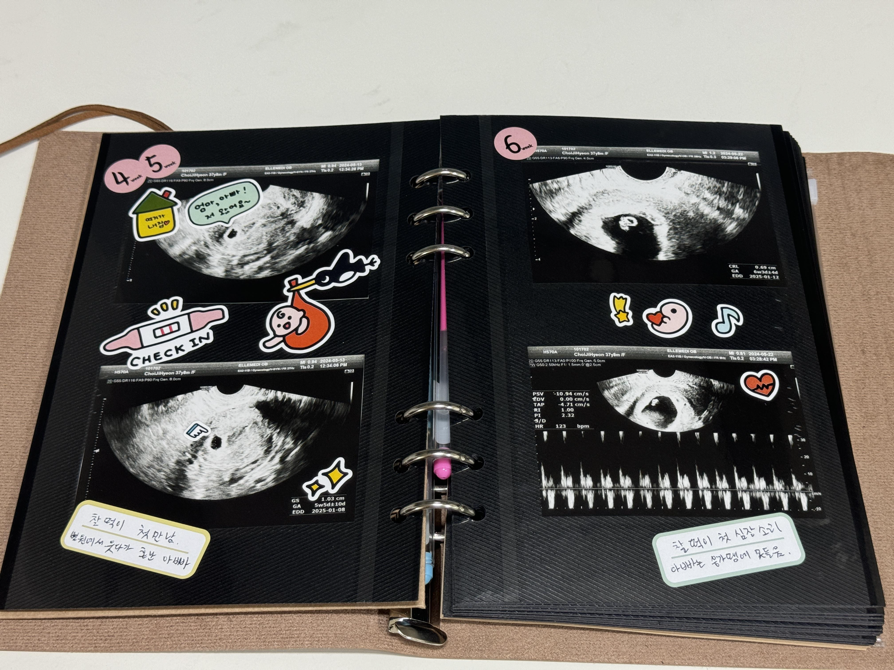 초음파 앨범 다꾸2