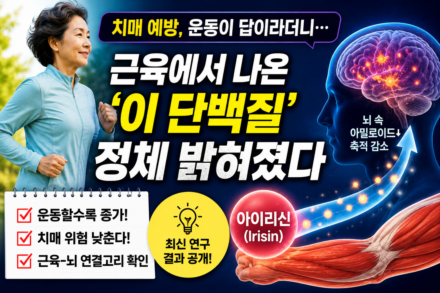 치매 예방 운동과 근육에서 분비되는 아이리신 단백질의 뇌 아밀로이드 축적 연관성