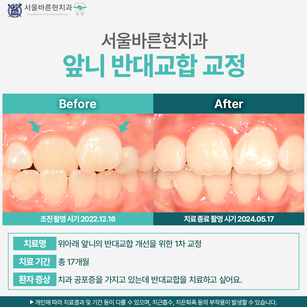 부산교정치과