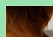 땀띠 원인과 증상 &amp; 치료