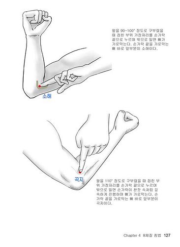 땀 많은 체질
