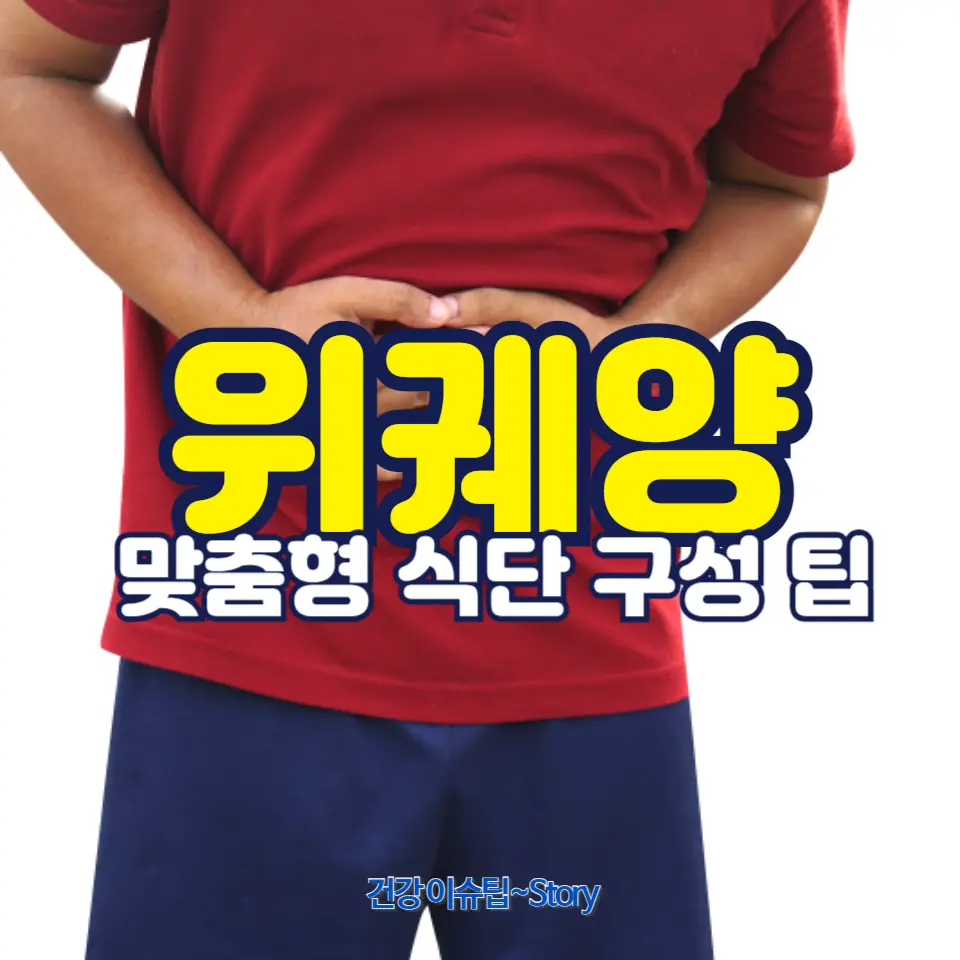 위궤양 관리에 도움되는 음식과 피해야 할 음식, 건강한 식사법