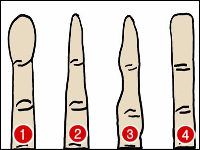 돈복이 있는 손가락 모양 손금