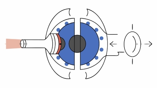 백내장수술 전과정