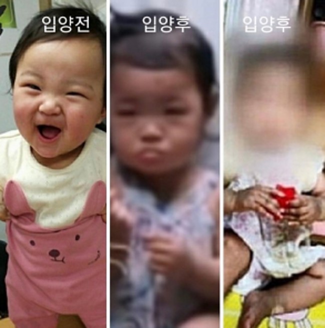 16개월 입양아 사망