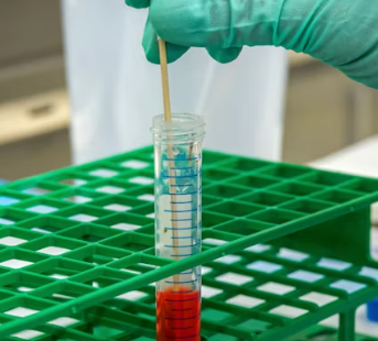 빈혈 치료방법 진단기준 합병증