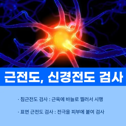 근전도 검사