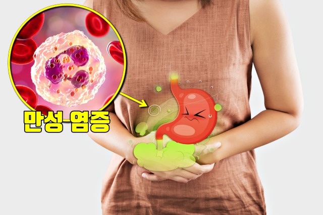 만성 염증 치료에 좋은 음식, 위염, 구내염, 장염, 염증성질환, 당뇨, 심근경색 유발