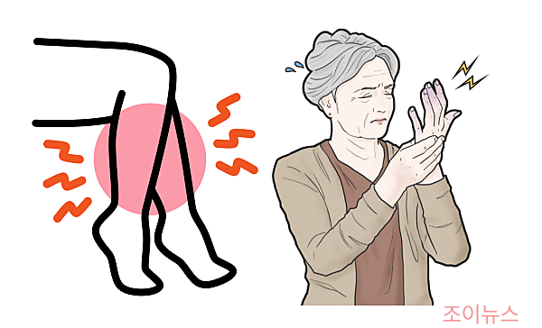 말초혈관질환을 표현한 모습, 다리저림