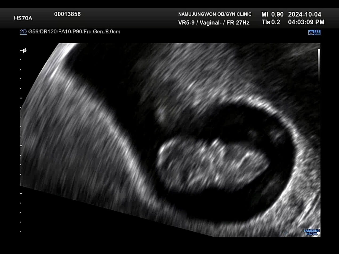 8주차-초음파-사진