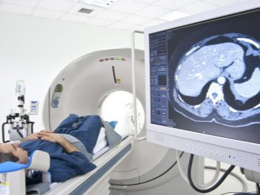 복부ct로 알수있는질병