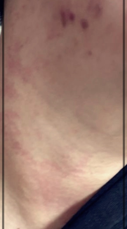 피부 기묘증 치료를 위한 실질적인 팁