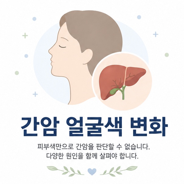 사람 얼굴과 간을 함께 배치해 간암과 얼굴색 변화의 관계를 설명하는 의료 정보 이미지
