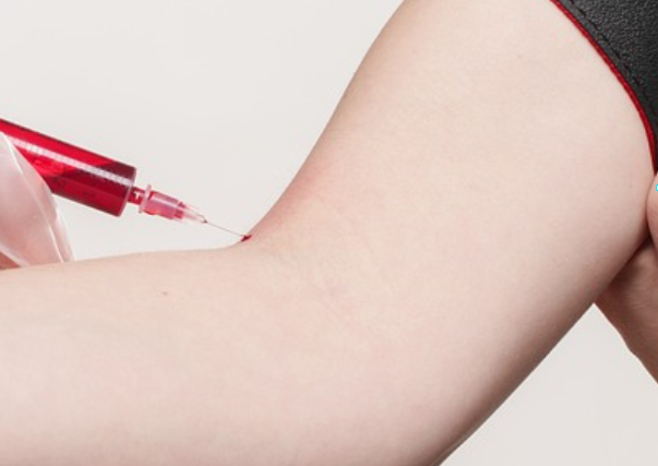 채혈-혈액-음주측정