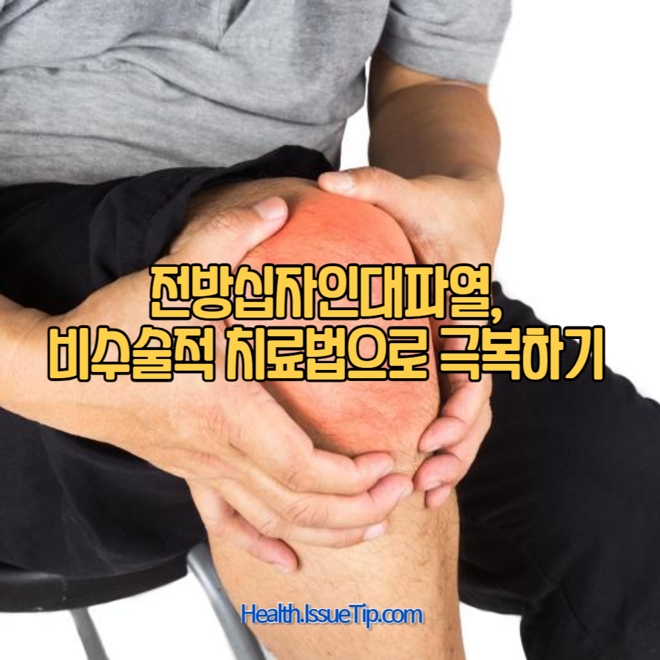 전방십자인대파열, 수술 없이 회복이 가능할까요?