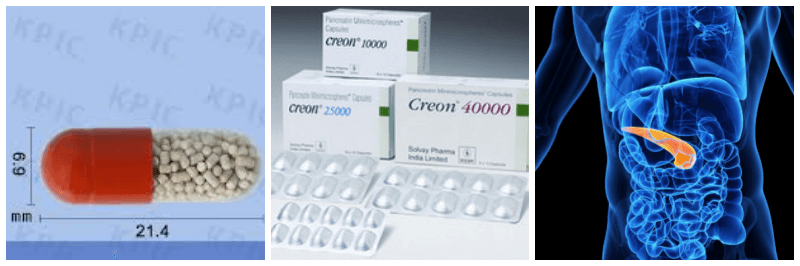 크레온캡슐, 췌장 사진