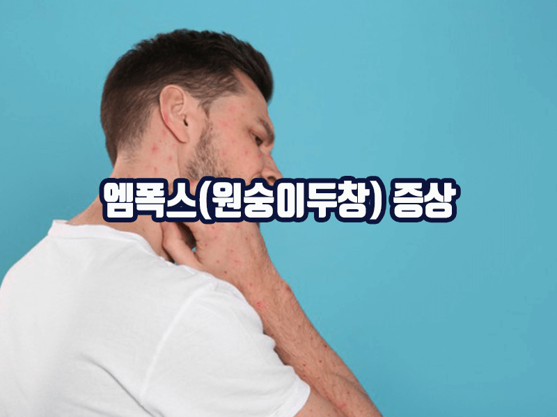엠폭스(원숭이두창)의 증상 - 피부발진, 합병증, 발열, 두통