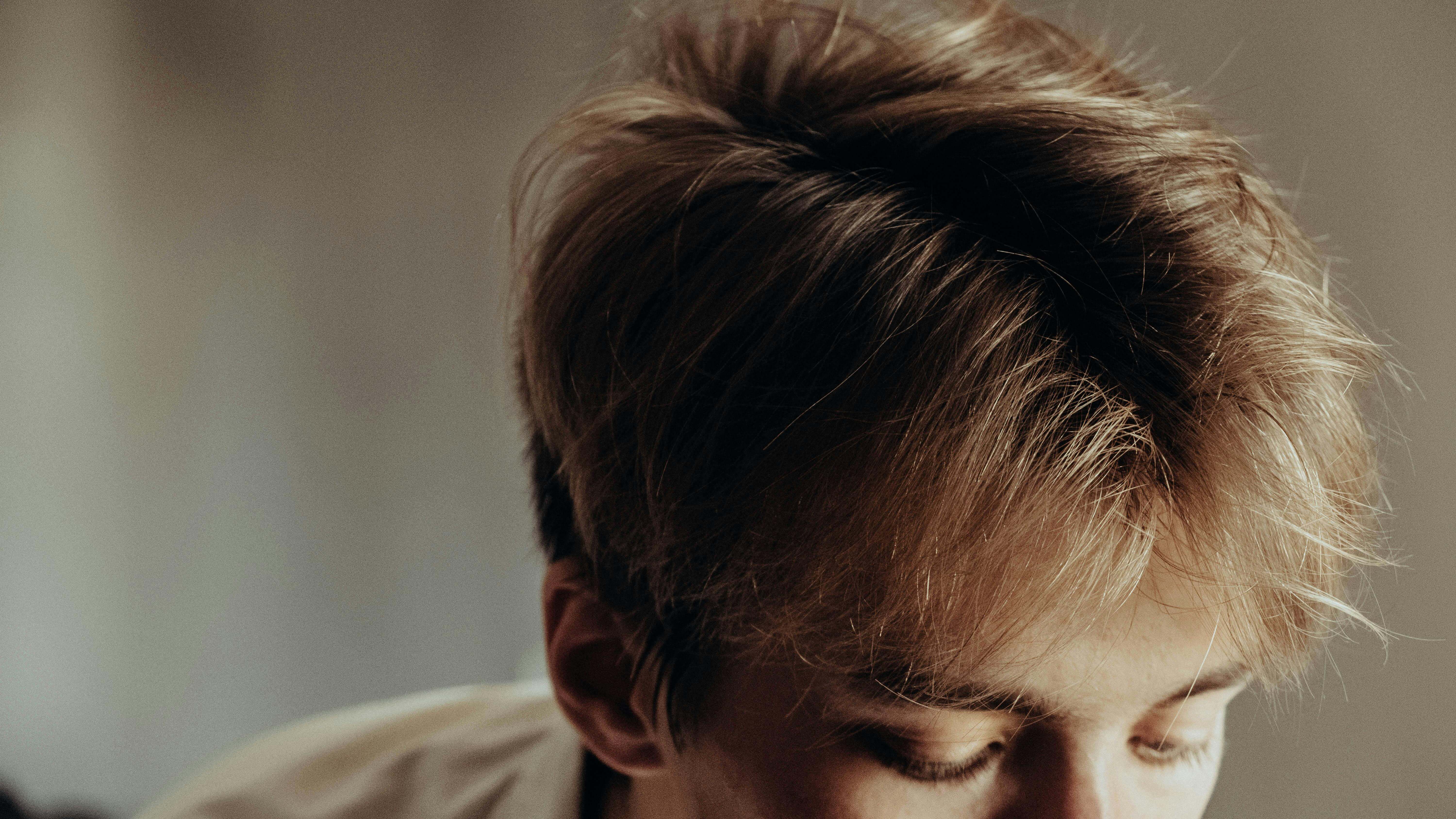 두피 건조 비듬 원인 7가지! 샴푸 바꿔도 계속 생기는 진짜 이유