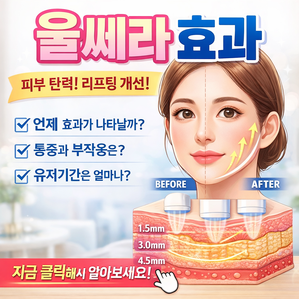울쎄라 효과