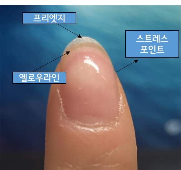 스트레스포인트