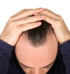 탈모-예방-방법
