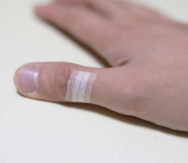 스테리스트립-사용법