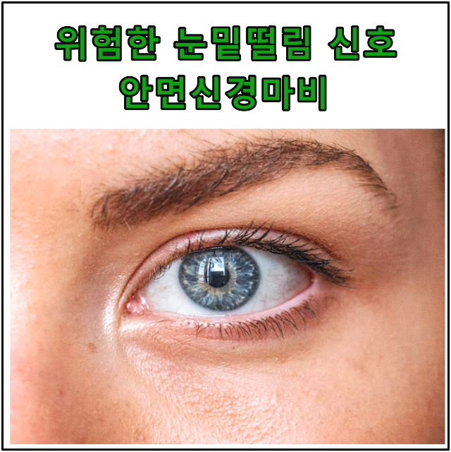 위험한 눈밑떨림 몸이 보내는 신호 안면신경마비
