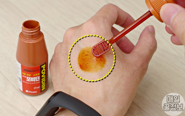 빨간약 포비돈 바르는법,빨간약 부작용,팁줌