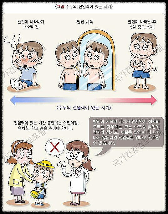 수두: 꼭 알아야 할 원인, 예방, 그리고 치료