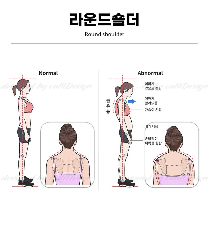 해부학으로 보는 라운드숄더 원인과 해결