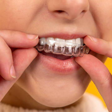 임플란트 지원금