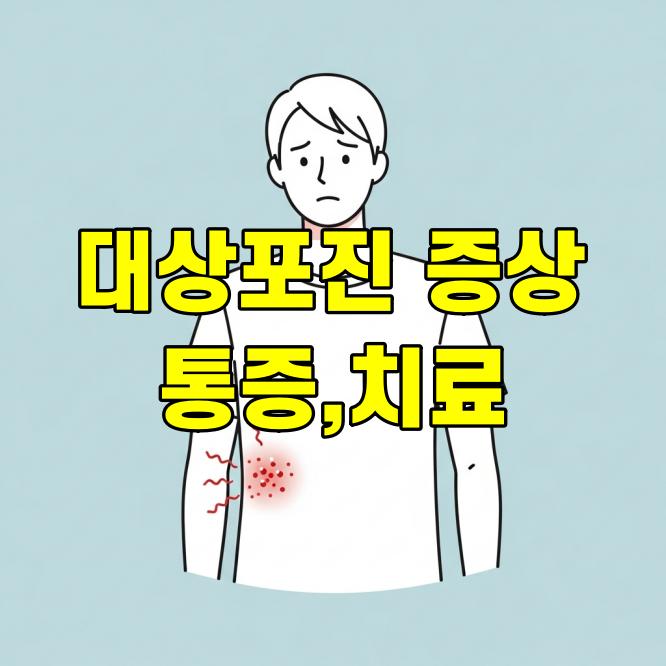 대상포진 증상, 초기 단계부터 통증 완화