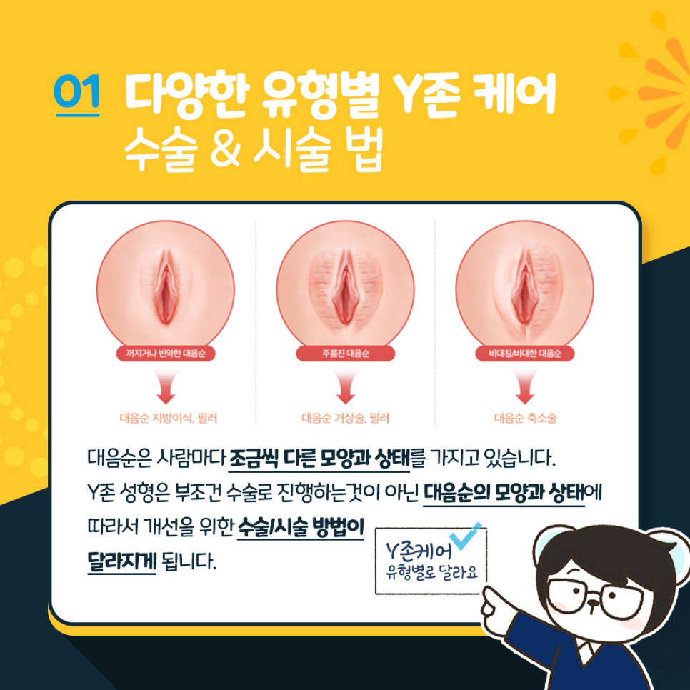 다양한 유형별 Y존케어 수술&시술법