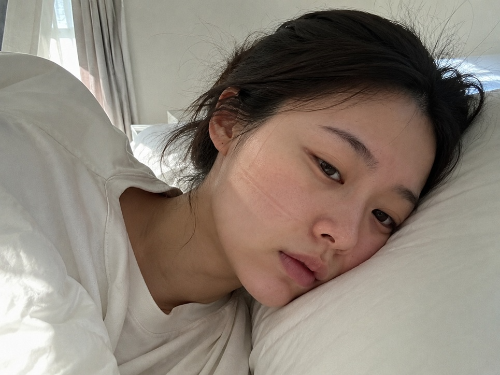 옆으로 누워 자고 일어난 뒤 볼에 베개 자국이 남아 있는 20대 여성의 자연스러운 아침 사진