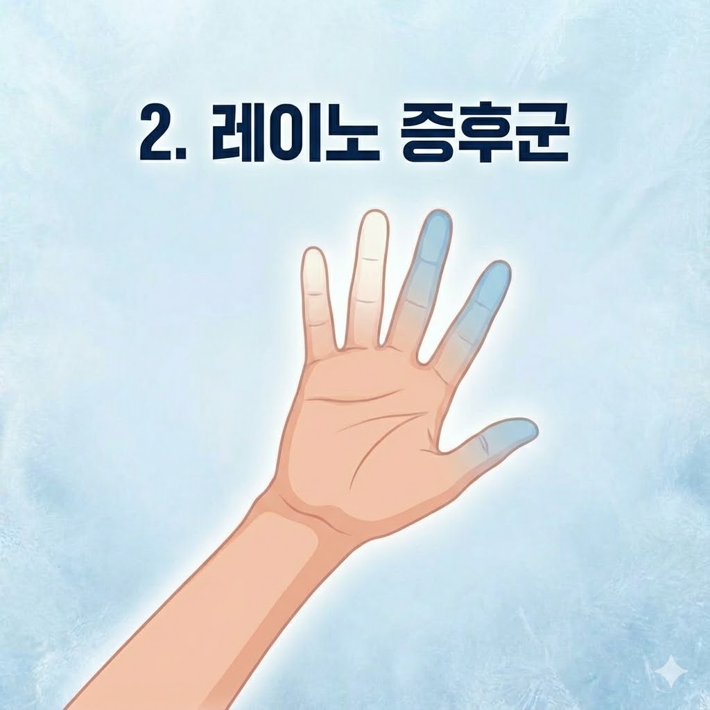 손발차가운이유