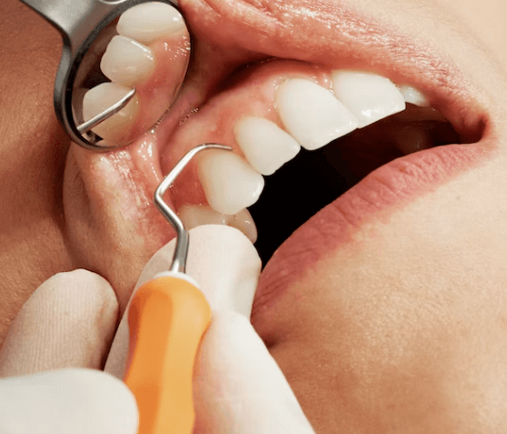 치실 사용법 - 필수