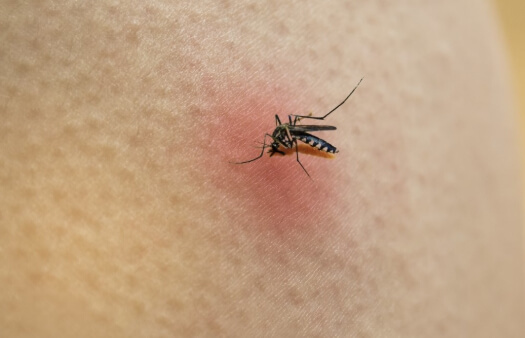 손목과 발목에 모기가 앉은 모습