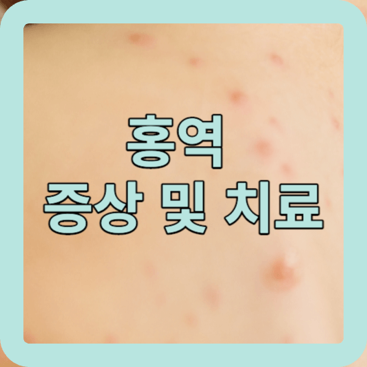 홍역의 증상&#44; 예방 및 치료법