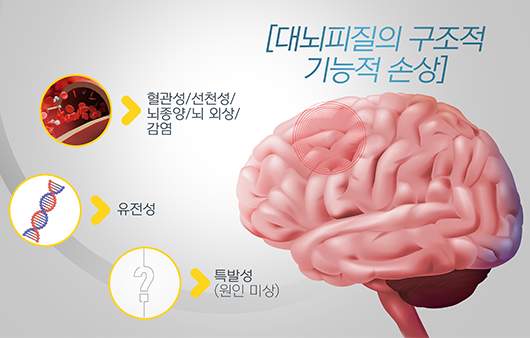 중풍의 전조증상