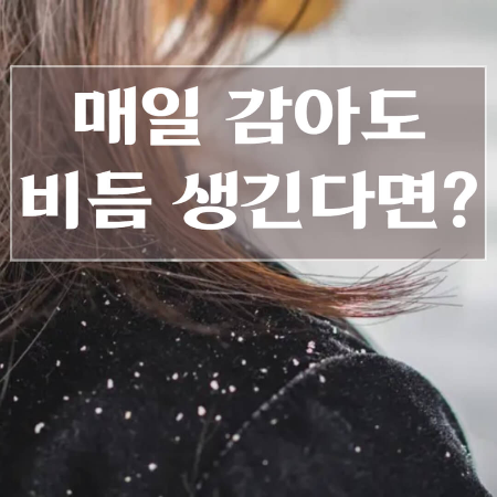 비듬이-생기는-원인