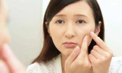 여드름의 신경 쓰이는 대처법