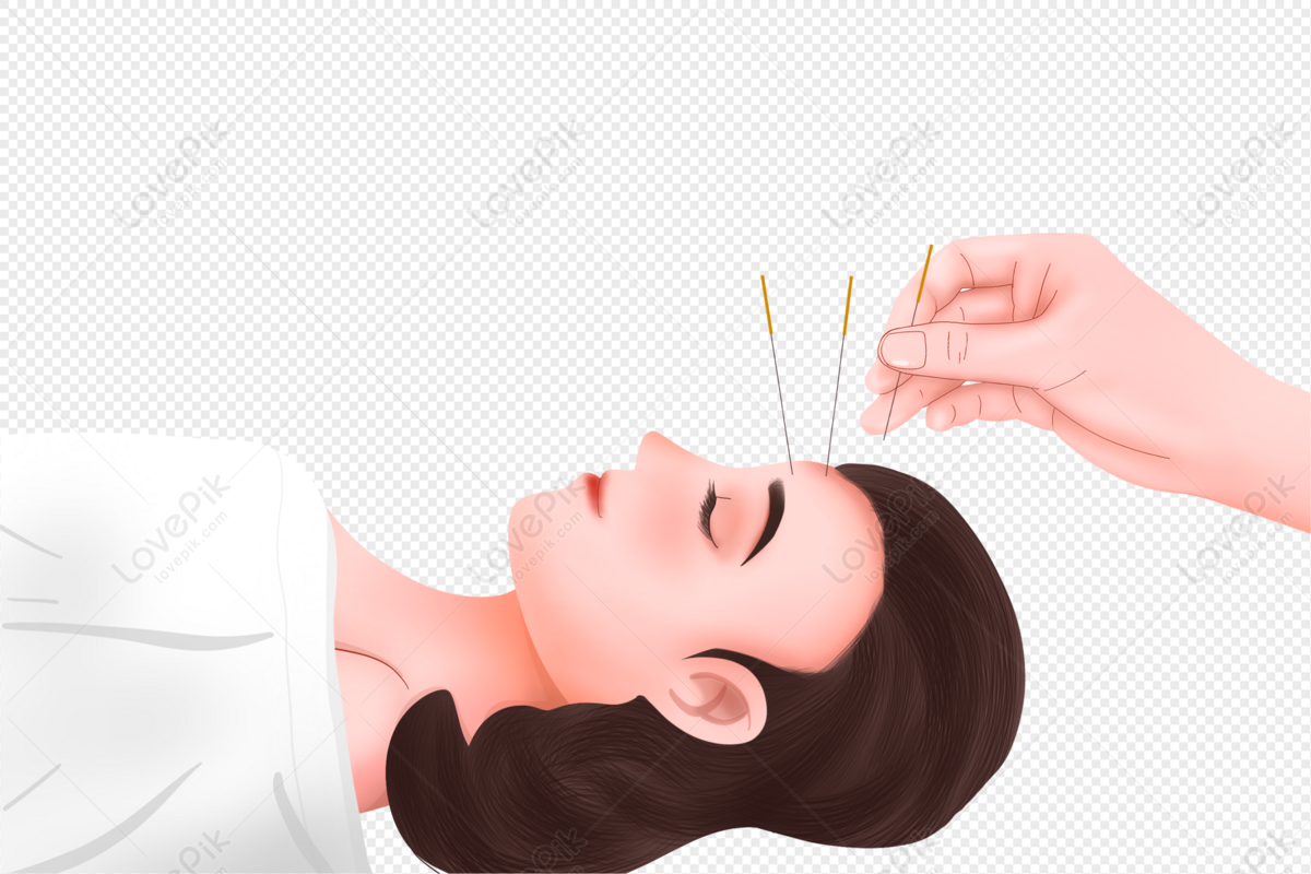 환자의 이마에 침을 놓고 있는 한의사의 손 모습