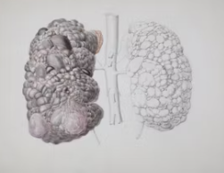 신장이 안좋으면 나타나는 증상