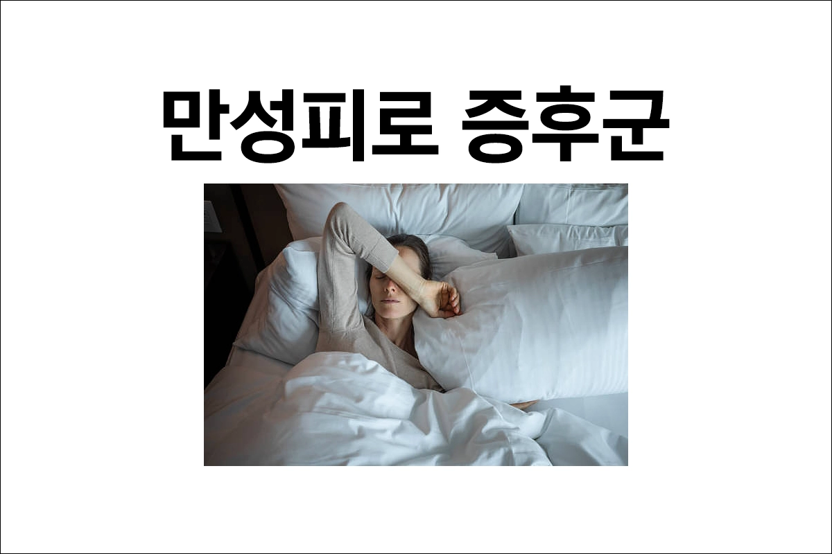 만성피로 증후군 원인 증상 치료 예방