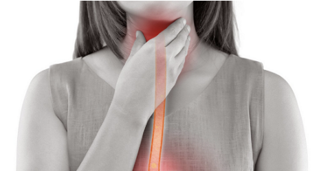 식도암 초기증상 27