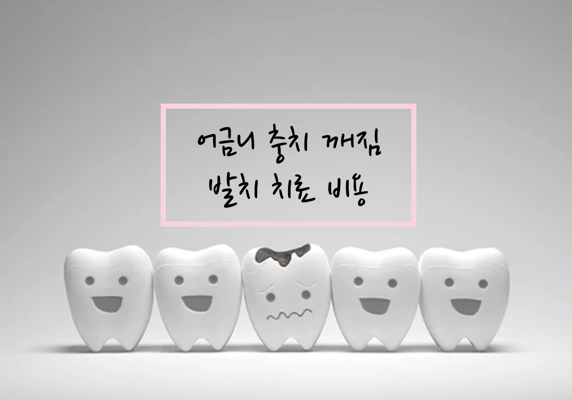 어금니 충치 깨짐